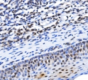 IHC staining of FFPE human tonsil tissue with TBP associated factor 4 antibody. HIER: boil tissue sections in pH8 EDTA for 20 min and allow to cool before testing.