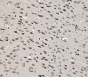 IHC staining of FFPE mouse brain tissue with TBP associated factor 4 antibody. HIER: boil tissue sections in pH8 EDTA for 20 min and allow to cool before testing.