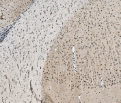 IHC staining of FFPE rat brain tissue with TBP associated factor 4 antibody. HIER: boil tissue sections in pH8 EDTA for 20 min and allow to cool before testing.
