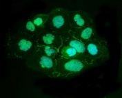 Immunofluorescent staining of FFPE human A431 cells with ZO2 antibody (green) and DAPI nuclear stain (blue). HIER: steam section in pH6 citrate buffer for 20 min.