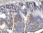 IHC staining of FFPE rat intestine tissue with Trim16 antibody. HIER: boil tissue sections in pH8 EDTA for 20 min and allow to cool before testing.