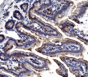 IHC staining of FFPE mouse intestine tissue with Trim16 antibody. HIER: boil tissue sections in pH8 EDTA for 20 min and allow to cool before testing.