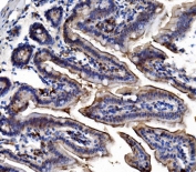 IHC staining of FFPE mouse intestine tissue with Trim16 antibody. HIER: boil tissue sections in pH8 EDTA for 20 min and allow to cool before testing.