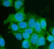 Immunofluorescent staining of FFPE human Caco-2 cells with Utrophin antibody (green) and DAPI nuclear stain (blue). HIER: steam section in pH6 citrate buffer for 20 min.