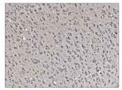 IHC staining of FFPE rat brain tissue with VAMP4 antibody. HIER: boil tissue sections in pH8 EDTA for 20 min and allow to cool before testing.