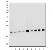 Western blot testing of human 1) U-87 MG, 2) T-47D, 3) K562, 4) PC-3, 5) ThP-1, 6) HEK293, 7) HL60, 8) rat brain and 9) mouse brain tissue lysate with VAMP4 antibody. Predicted molecular weight ~16 kDa.