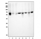 Western blot testing of human 1) K562, 2) U-2 OS, 3) HepG2, 4) U-87 MG, 5) rat lung, 6) rat PC-12, 7) mouse lung and 8) mouse NIH 3T3 cell lysate with Elongator complex protein 3 antibody. Predicted molecular weight ~62 kDa.