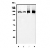 Western blot testing of 1) human HeLa, 2) human A431, 3) rat brain and 4) mouse brain tissue lysate with Clathrin heavy chain antibody. Predicted molecular weight ~192 kDa.