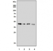 Western blot testing of rat 1) thymus, 2) liver, 3) testis and 4) RH35 cell lysate with Zwint antibody. Predicted molecular weight ~31 kDa.