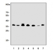 Western blot testing of human 1) HL60, 2) K562, 3) Raji, 4) Jurkat, 5) rat RH35, 6) mouse spleen and 7) mouse ANA-1 cell lysate with CD154 antibody. Expected molecular weight: 29-39 kDa (depending on glycosylation level) or ~18 kDa (soluble form).