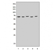 Western blot testing of 1) human HeLa, 2) human Caco-2, 3) human A431, 4) rat lung and 5) mouse RAW264.7 cell lysate with cGAS antibody. Predicted molecular weight ~59 kDa.