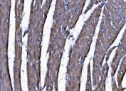 IHC staining of FFPE rat heart tissue with CHCHD10 antibody. HIER: boil tissue sections in pH8 EDTA for 20 min and allow to cool before testing.
