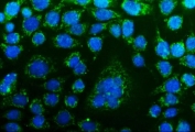 Immunofluorescent staining of FFPE human Caco-2 cells with CHCHD10 antibody (green) and DAPI nuclear stain (blue). HIER: steam section in pH6 citrate buffer for 20 min.