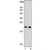 Western blot testing of human 1) MCF7 and 2) Caco-2 cell lysate with Claudin 3 antibody. Predicted molecular weight ~23 kDa.