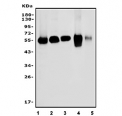 Western blot testing of 1) human Jurkat, 2) rat spleen, 3) rat thymus, 4) mouse spleen and 5) mouse thymus tissue lysate with Coronin 1a antibody. Predicted molecular weight ~51 kDa.