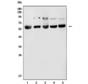 Western blot testing of 1) monkey COS-7, 2) human A431, 3) human K562, 4) mouse liver and 5) mouse kidney tissue lysate with Lanosterol 14-alpha demethylase antibody. Predicted molecular weight ~57 kDa.