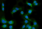 Immunofluorescent staining of FFPE human Caco-2 cells with Lanosterol 14-alpha demethylase antibody (green) and DAPI nuclear stain (blue). HIER: steam section in pH6 citrate buffer for 20 min.