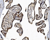 IHC staining of FFPE human placental tissue with DCTN1 antibody. HIER: boil tissue sections in pH8 EDTA for 20 min and allow to cool before testing.