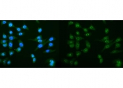 Immunofluorescent staining of FFPE human Caco-2 cells. Left: DCTN1 antibody (green) and DAPI nuclear stain (blue), Right: DCTN1 antibody. HIER: steam section in pH6 citrate buffer for 20 min.