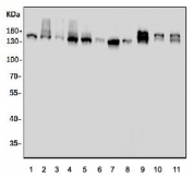 Western blot testing of human 1) HeLa, 2) Jurkat, 3) placenta, 4) U-87 MG, 5) Caco-2, 6) U-2 OS, 7) HEK293, 8) HepG2, 9) rat brain, 10) rat stomach and 11) mouse brain tissue lysate with DCTN1 antibody. Expected molecular weight: 142-150 kDa.