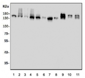 Western blot testing of human 1) HeLa, 2) Jurkat, 3) placenta, 4) U-87 MG, 5) Caco-2, 6) U-2 OS, 7) HEK293, 8) HepG2, 9) rat brain, 10) rat stomach and 11) mouse brain tissue lysate with DCTN1 antibody. Expected molecular weight: 142-150 kDa.