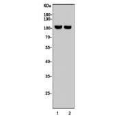 Western blot testing of 1) rat brain and 2) mouse brain tissue lysate with DLG4 antibody. Predicted molecular weight ~80 kDa but routinely observed at 90~95 kDa.