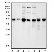 Western blot testing of human 1) HepG2, 2) PC-3, 3) A549, 4) HeLa, 5) Caco-2, 6) rat pancreas and 7) mouse pancreas tissue lysate with FOXA2 antibody. Predicted molecular weight ~50 kDa.