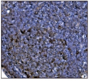 IHC staining of FFPE rat lymph node tissue with Glutamate-oxaloacetate transaminase 2 antibody. HIER: boil tissue sections in pH8 EDTA for 20 min and allow to cool before testing.