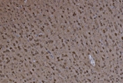 IHC staining of FFPE mouse brain tissue with Glutamate-oxaloacetate transaminase 2 antibody. HIER: boil tissue sections in pH8 EDTA for 20 min and allow to cool before testing.