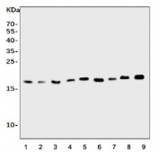 Western blot testing of rat 1) spleen, 2) brain, 3) thymus, 4) kidney and mouse 5) spleen, 6) kidney, 7) RAW264.7 and 8) NIH 3T3 cell lysate with Il1ra antibody. Predicted molecular weight ~20 kDa.