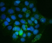 Immunofluorescent staining of FFPE human A431 cells with Integrin linked protein kinase antibody (green) and DAPI nuclear stain (blue). HIER: steam section in pH6 citrate buffer for 20 min.