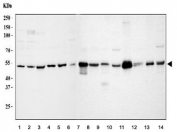 Western blot testing of human 1) MCF7, 2) HeLa, 3) U-87 MG, 4) A431, 5) U-2 OS, 6) PC-3, 7) rat heart, 8) rat kidney, 9) rat skeletal muscle, 10) mouse heart, 11) mouse kidney, 12) mouse skeletal muscle and 13) mouse C2C12 lysate with Integrin linked protein kinase antibody. Expected molecular weight: 51-59 kDa.
