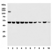 Western blot testing of human 1) HT1080, 2) Jurkat, 3) K562, 4) HL60, 5) HEK293, 6) U937, 7) HepG2, 8) rat heart, 9) rat kidney and 10) mouse kidney tissue lysate with MIEF1 antibody. Predicted molecular weight ~51 kDa.