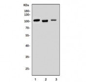Western blot testing of human 1) Raji, 2) HEK293 and 3) Caco-2 cell lysate with B-Myb antibody. Predicted molecular weight: ~79 kDa, may also be observed at 100~110 kDa.