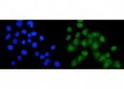 Immunofluorescent staining of FFPE human Caco-2 cells with B-Myb antibody (green) and DAPI nuclear stain (blue). HIER: steam section in pH6 citrate buffer for 20 min.