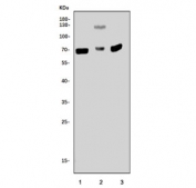 Western blot testing of 1) rat brain, 2) rat PC-12 and 3) mouse brain tissue lysate with p21-activated kinase 1 antibody. Expected molecular weight: 60-70 kDa.
