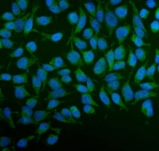 Immunofluorescent staining of FFPE human HeLa cells with PFKFB2 antibody (green) and DAPI nuclear stain (blue). HIER: steam section in pH6 citrate buffer for 20 min.