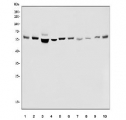 Western blot testing of human 1) K562, 2) HepG2, 3) Caco-2, 4) HeLa, 5) A431, 6) PC-3, 7) rat heart, 8) rat PC-12, 9) mouse heart and 10) mouse RAW364.7 cell lysate with PFKFB2 antibody. Predicted molecular weight ~58 kDa.