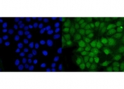 Immunofluorescent staining of FFPE human MCF7 cells with Proteasome subunit beta type-5 antibody (green) and DAPI nuclear stain (blue). HIER: steam section in pH6 citrate buffer for 20 min.