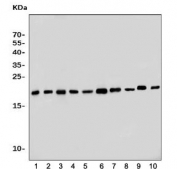 Western blot testing of 1) human HeLa, 2) human HepG2, 3) human A549, 4) rat liver, 5) rat pancreas, 6) rat testis, 7) rat kidney, 8) mouse liver, 9) mouse testis and 10) mouse kidney tissue lysate with Proteasome subunit beta type-5 antibody. Predicted molecular weight: 18-28 kDa (multiple isoforms).