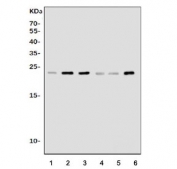 Western blot testing of 1) rat lung, 2) rat spleen, 3) rat thymus, 4) mouse lung, 5) mouse spleen and 6) mouse thymus tissue lysate with Pycard antibody. Predicted molecular weight ~22 kDa.