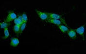 Immunofluorescent staining of FFPE human HepG2 cells with SEC23A antibody (green) and DAPI nuclear stain (blue). HIER: steam section in pH6 citrate buffer for 20 min.