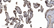 IHC staining of FFPE human placental tissue with SEC23A antibody. HIER: boil tissue sections in pH8 EDTA for 20 min and allow to cool before testing.