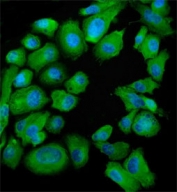 Immunofluorescent staining of FFPE human PC-3 cells with SND1 antibody (green) and DAPI nuclear stain (blue). HIER: steam section in pH6 citrate buffer for 20 min.