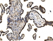 IHC staining of FFPE human placental tissue with SND1 antibody. HIER: boil tissue sections in pH8 EDTA for 20 min and allow to cool before testing.