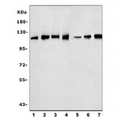 Western blot testing of human 1) HeLa, 2) Raji, 3) U-87 MG, 4) HUVEC, 5) rat stomach, 6) rat pancreas and 7) mouse stomach tissue lysate with SND1 antibody. Predicted molecular weight ~102 kDa.