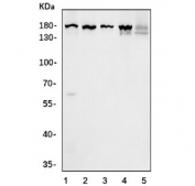 Western blot testing of 1) rat testis, 2) rat C6, 3) rat PC-12, 4) mouse NIH 3T3 and 5) human HeLa cell lysate with STIL antibody. Predicted molecular weight ~143 kDa.