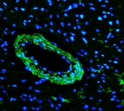 Immunofluorescent staining of FFPE rat heart tissue with TAGLN antibody (green) and DAPI nuclear stain (blue). HIER: steam section in pH8 EDTA buffer for 20 min.