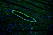 Immunofluorescent staining of FFPE mouse heart tissue with TAGLN antibody (green) and DAPI nuclear stain (blue). HIER: steam section in pH8 EDTA buffer for 20 min.