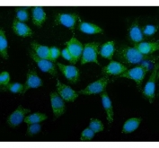 Immunofluorescent staining of FFPE human Caco-2 cells with TAGLN antibody (green) and DAPI nuclear stain (blue). HIER: steam section in pH6 citrate buffer for 20 min.
